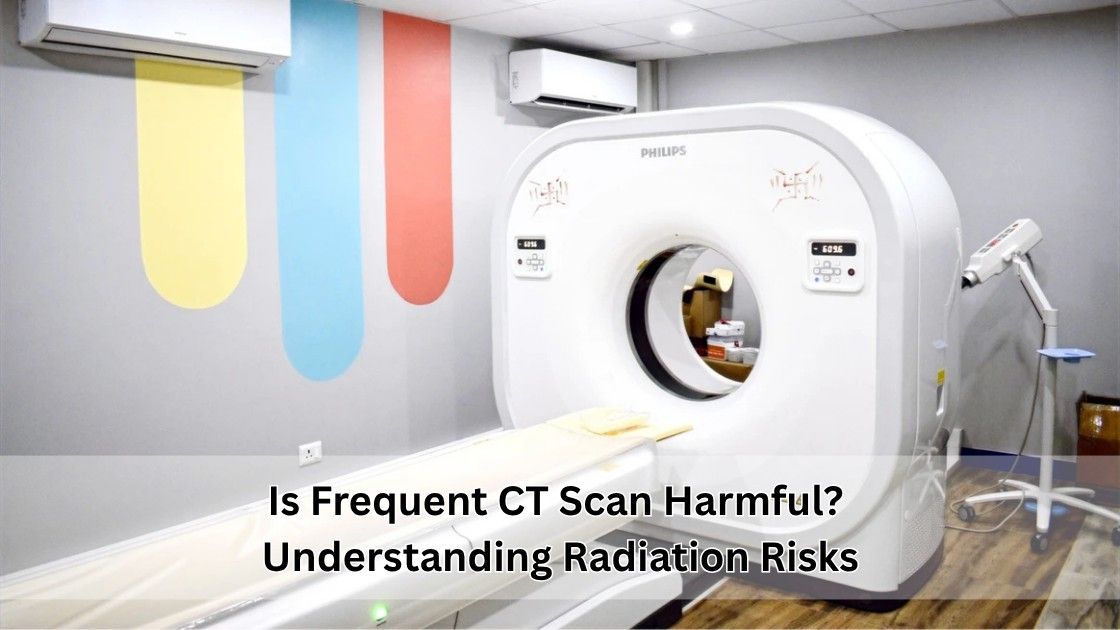 Is Frequent CT Scan Harmful? Understand Radiation Risks & Safety