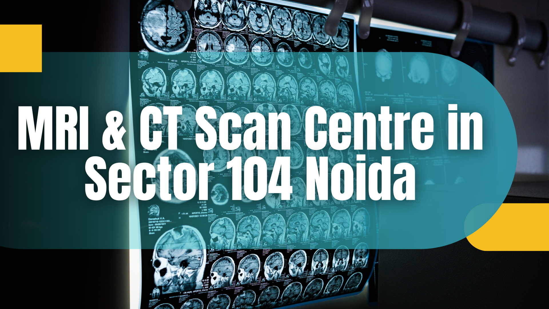 MRI & CT Scan Centre in Sector 104 Noida
